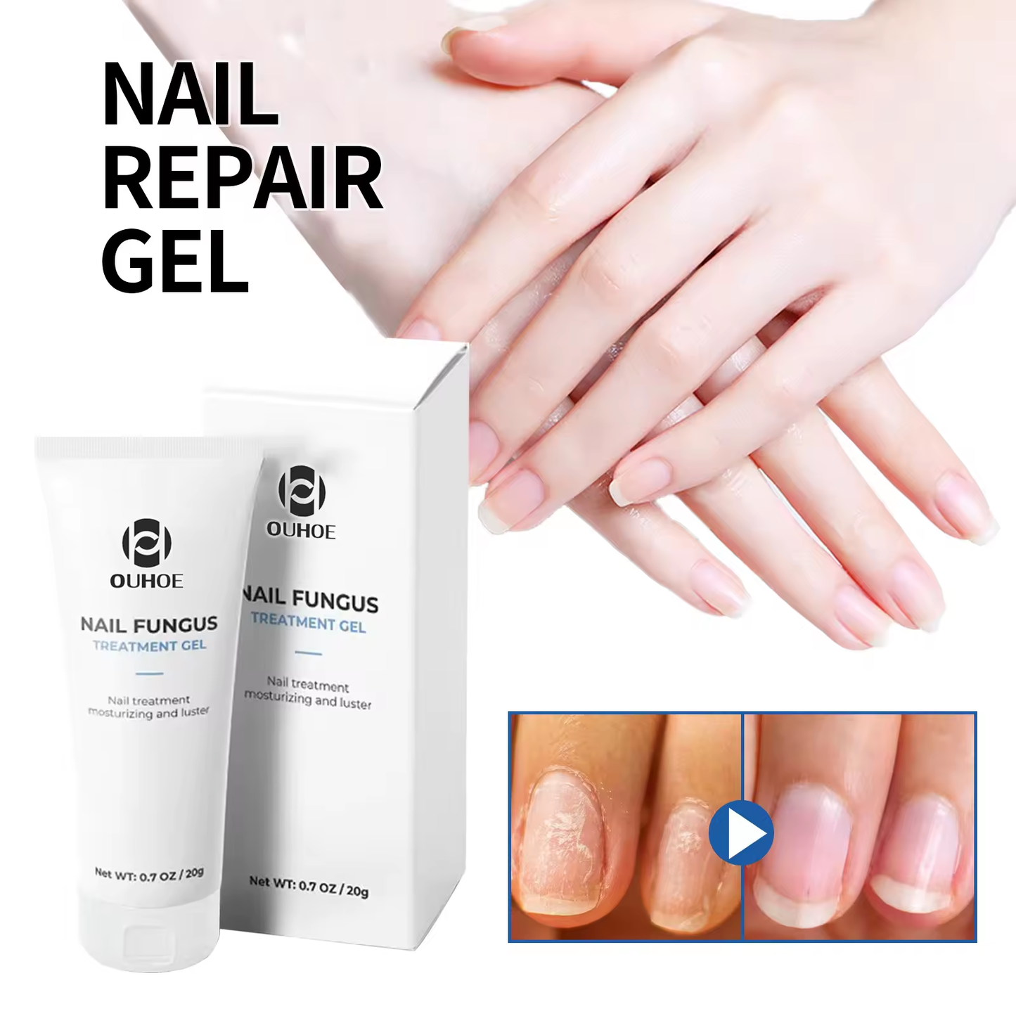 Serum za glivice